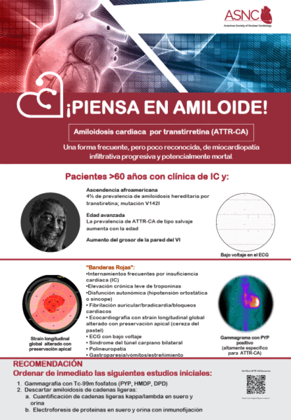 Poster piensa amiloide para pisos de internamiento poster image