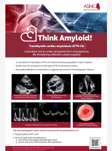Think-Amyloid-Echocardiography-Laboratory-Poster