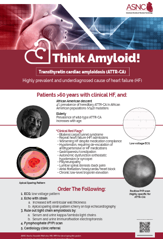 Think-Amyloid-Inpatient-Floors-Poster