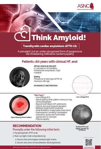 Think_Amyloid_Primary_Care_Clinics_poster