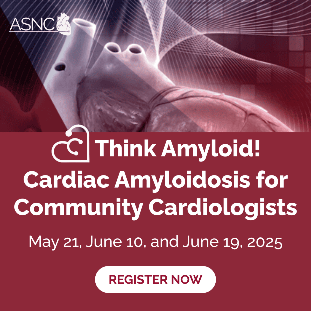 Think Amyloid program for Community Cardiologists