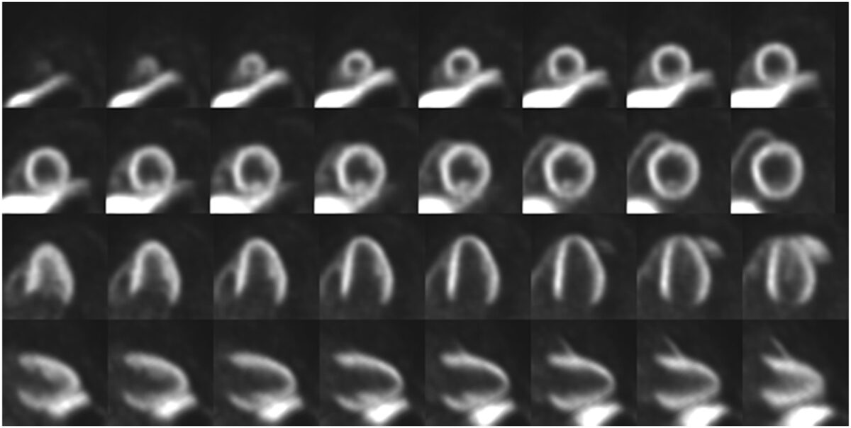 Example of XTR003 PET images