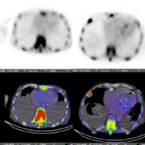 ASNC2025_Amyloid_Track ASNC2025_Amyloid_Track