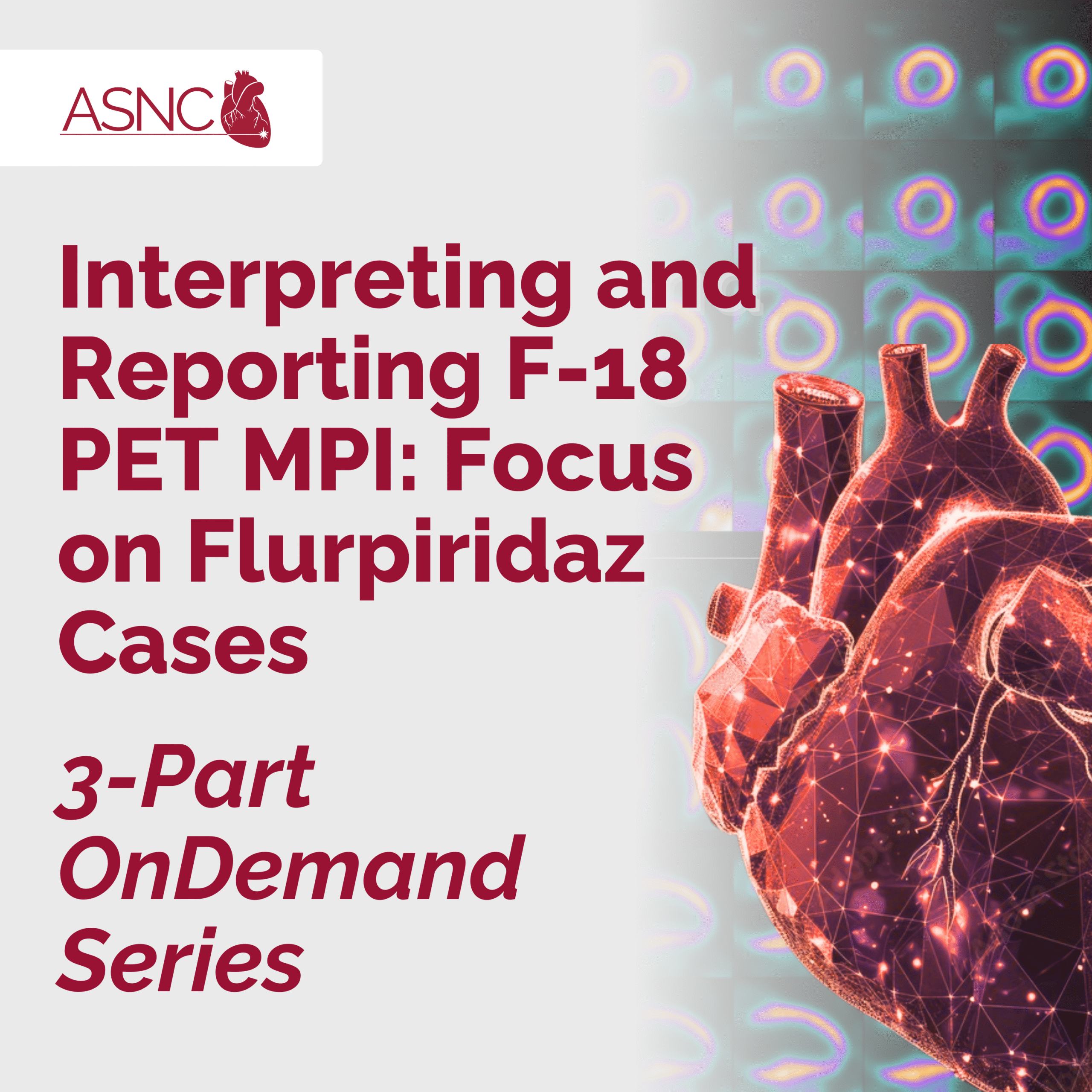 Interpreting and Reporting F-18 PET MPI 3-part series Interpreting and Reporting F-18 PET MPI 3-part series
