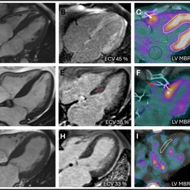 JNC-May2025-EditorsChoiceFig-768x658
