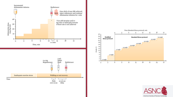 2026 ASNC Guideline for Stress Testing in Single-Photon Emission Computed Tomography (SPECT) and Positron Emission Tomography (PET) Myocardial Perfusion Imaging chart